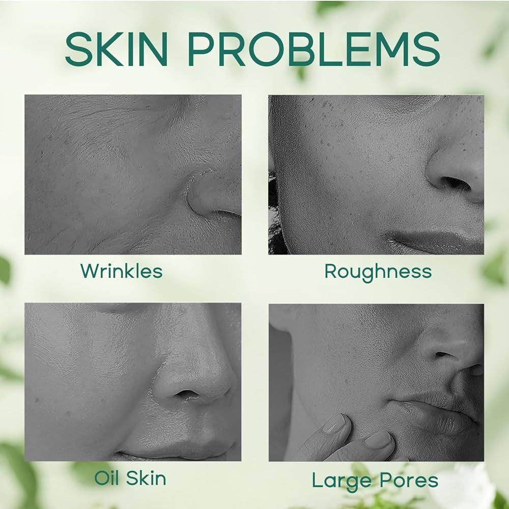 KORMESIC Exfoliate Oil Control Minimize Pores Salicylic Acid Cream