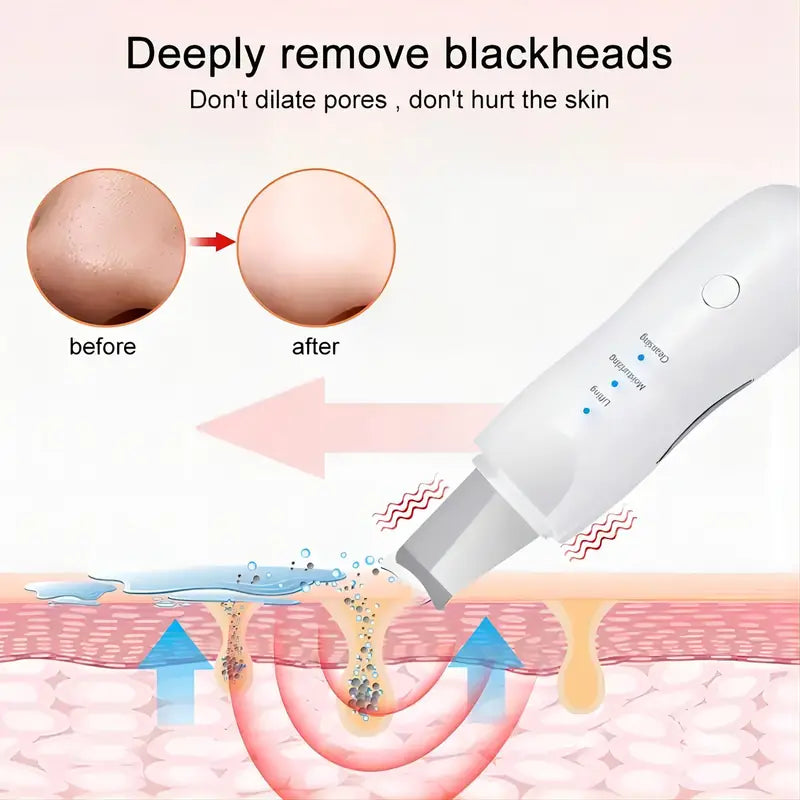 Home Face Pore Cleaning Massage Spatula Machine Exfoliating & Suctioning Blackheads & Acne