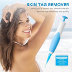 Auto Skin Tag Remove Kit