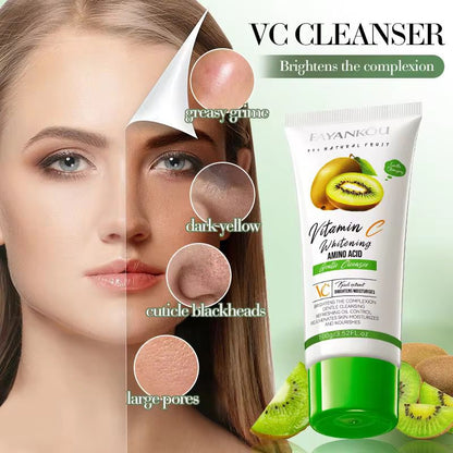 FAYANKOU Kiwifruit Extract Vitamin C Whitening Cleansing Wash Oil Control Hydrating and Smoothing Brightening Skin