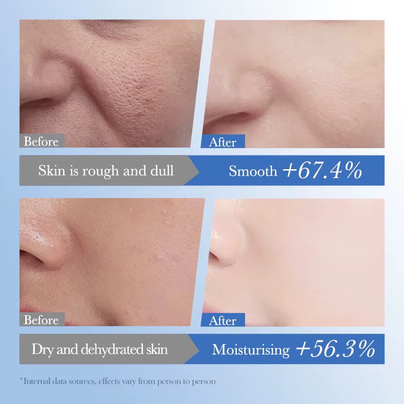 Sadoer Caviar + HA Anti-Aging Repair Moisturizing Lotion