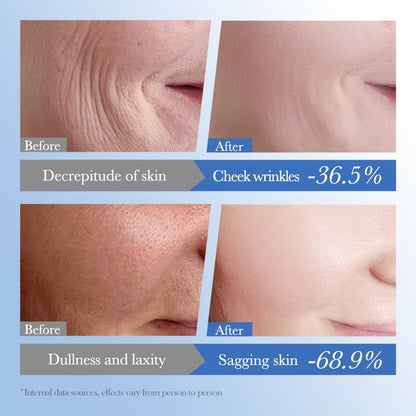 Sadoer Caviar + HA Anti-Aging Repair Moisturizer