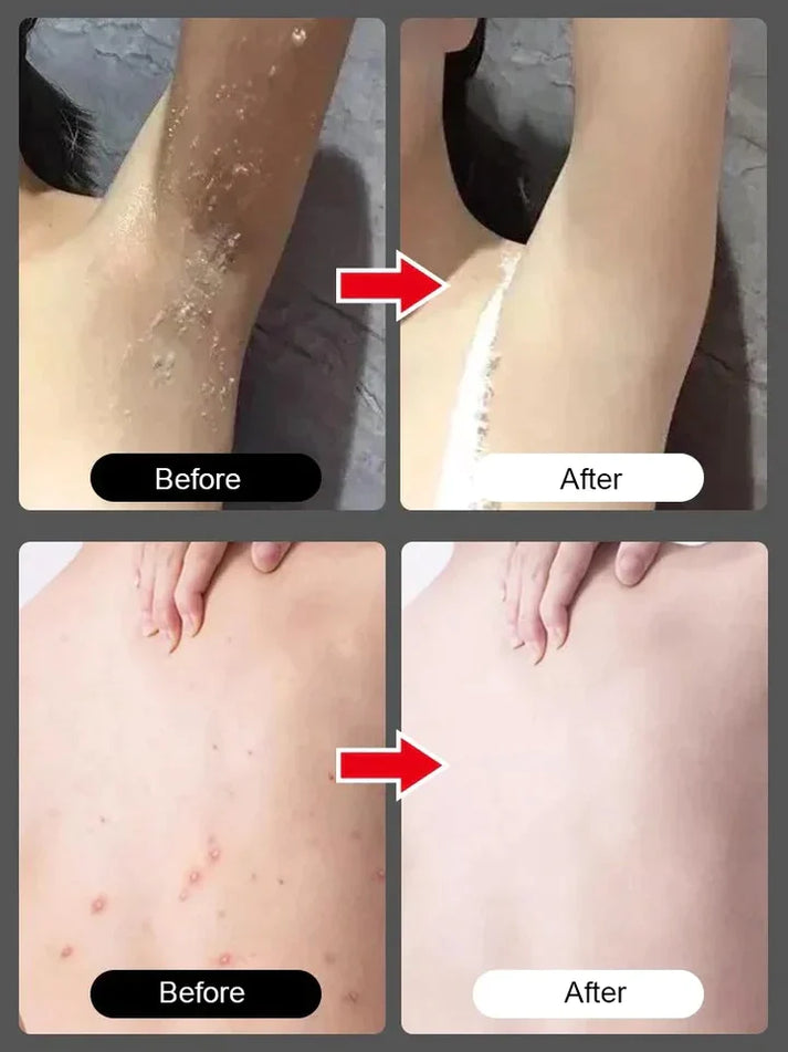 Bioaqua Peach Exfoliation Scrub Gel – beautygirl-pk