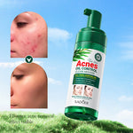 Sadoer Tea Tree Acnes Oil Control Gentle Acne Clean Mousse