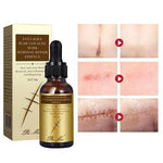 Pei Mei Collagen Scar And Acne Mark Removal Repair Essence