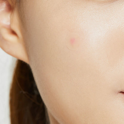 COSRX Acne Pimple Master Patch Orignal