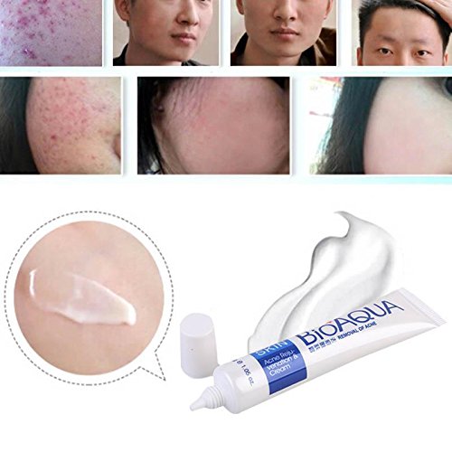 BIOAQUA Face Skin Care Acne Anti-Wrinkle Removal Cream Spots Scar Blemish Marks 30g