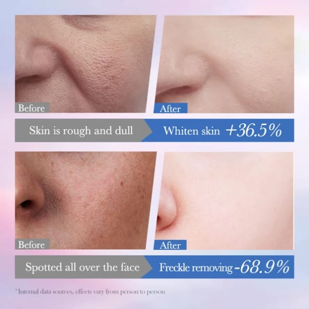 Sadoer 10% Niacinamide Spot Removal Hydrating Serum