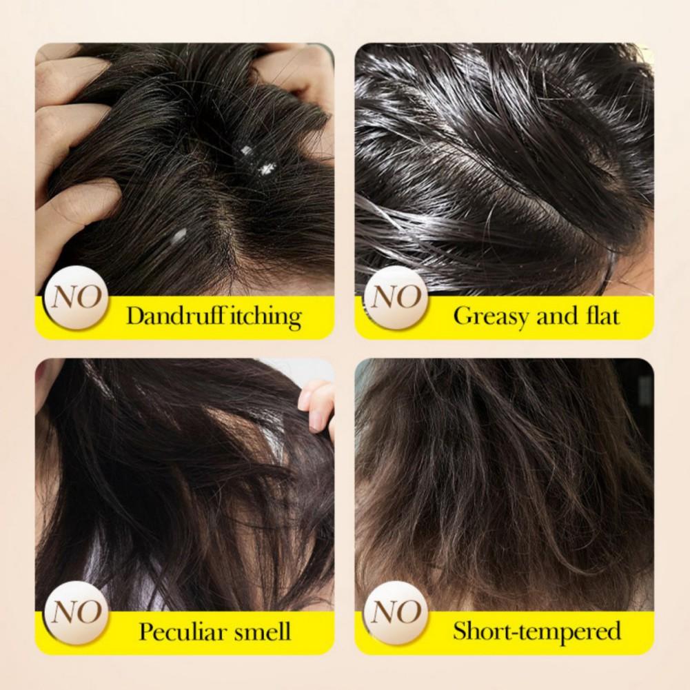 Sadoer Solid Shampoo Handmade Soap Olive Essence Anti Dandruff