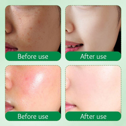 Sadoer Milk Avocado Organic Skin Care Anti-Aging Beauty Cream Korean Goat Milk & Avocado Moisturizing with Niacinamide & Vitamin E Face Cream