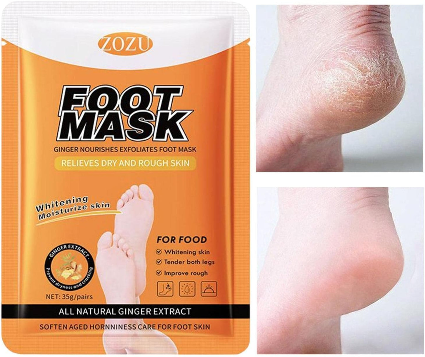 ZOZU Ginger Foot Cream for Dry and Cracked Heels