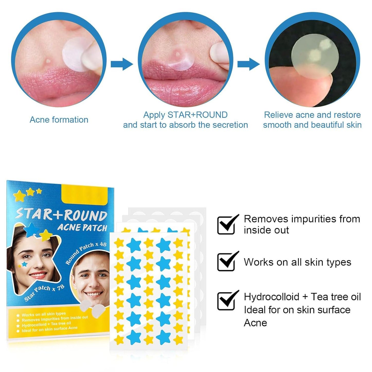 Sadoer Acne Patches Round Plus Star 36 Patches