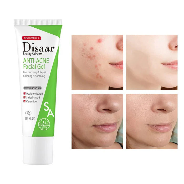 Disaar Ceramide Anti-Acne Facial Gel Moisturizing Face 30g