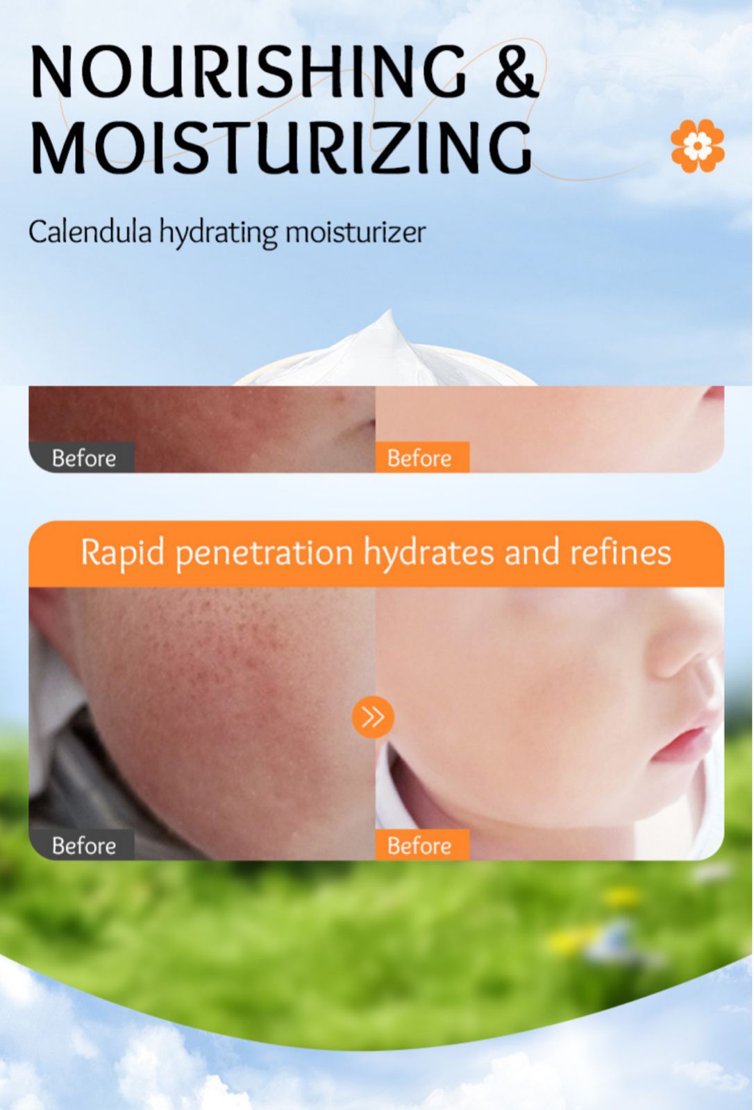 Sadoer Calendula Amino Acid Formula Baby Moist Cream – 50 g