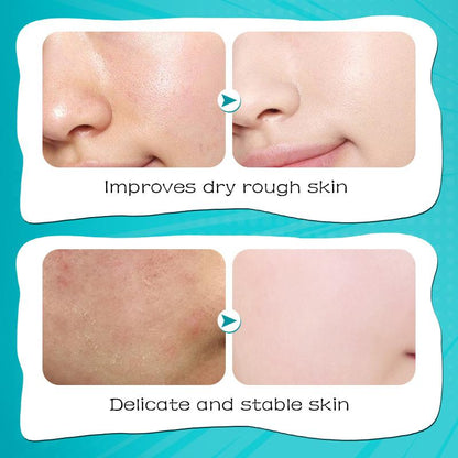 Sadoer Hyaluronic Acid Moisturizing Face Mask