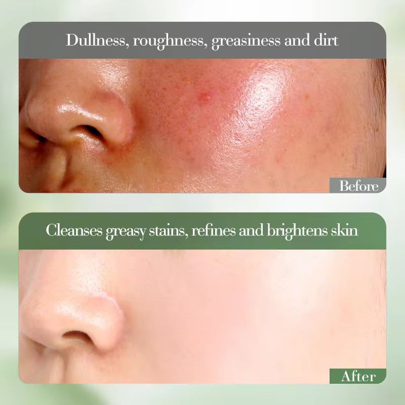 FAYANKOU Kiwifruit Extract Vitamin C Whitening Cleansing Wash Oil Control Hydrating and Smoothing Brightening Skin