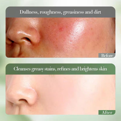 FAYANKOU Kiwifruit Extract Vitamin C Whitening Cleansing Wash Oil Control Hydrating and Smoothing Brightening Skin