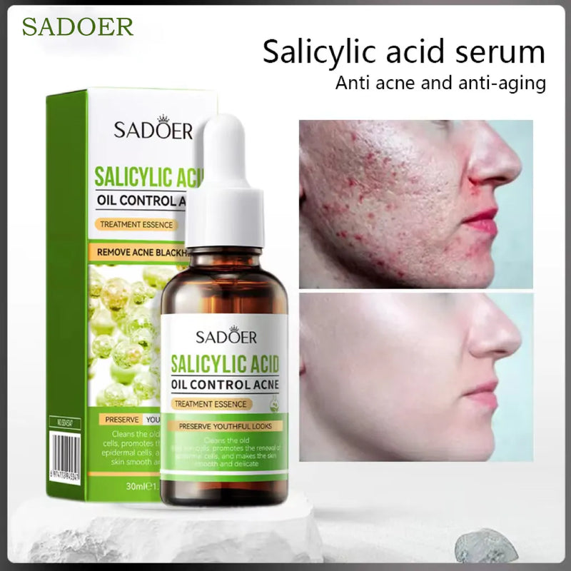 SADOER Salicylic Acid Oil Control Acne Serum 30ml