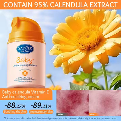 SADOER Calendula Vitamin E Gentle Soothing Baby Anti-Cracking Cream 50g