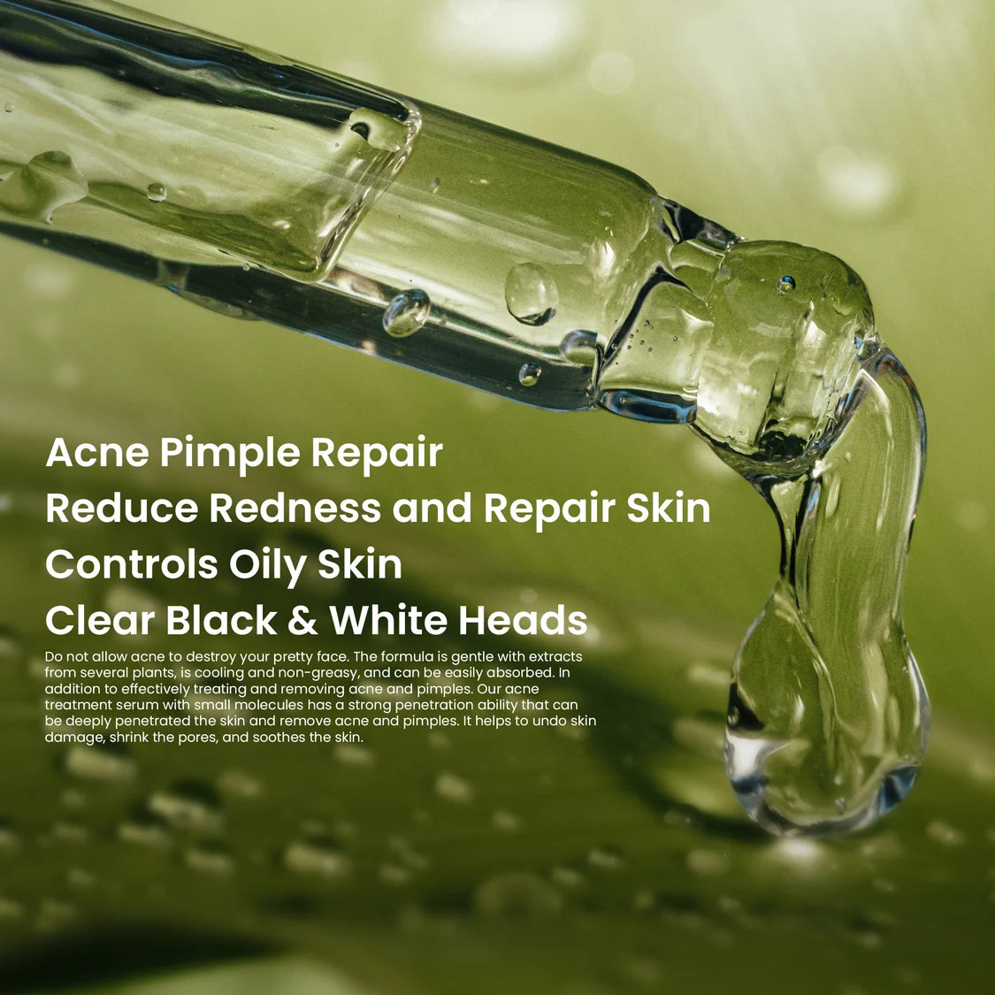 Rivaj Acne Treatment  Fcae Serum 30ml