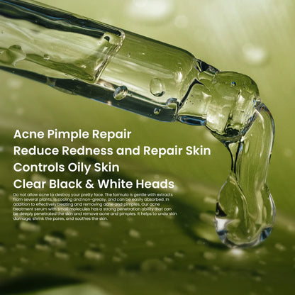 Rivaj Acne Treatment  Fcae Serum 30ml