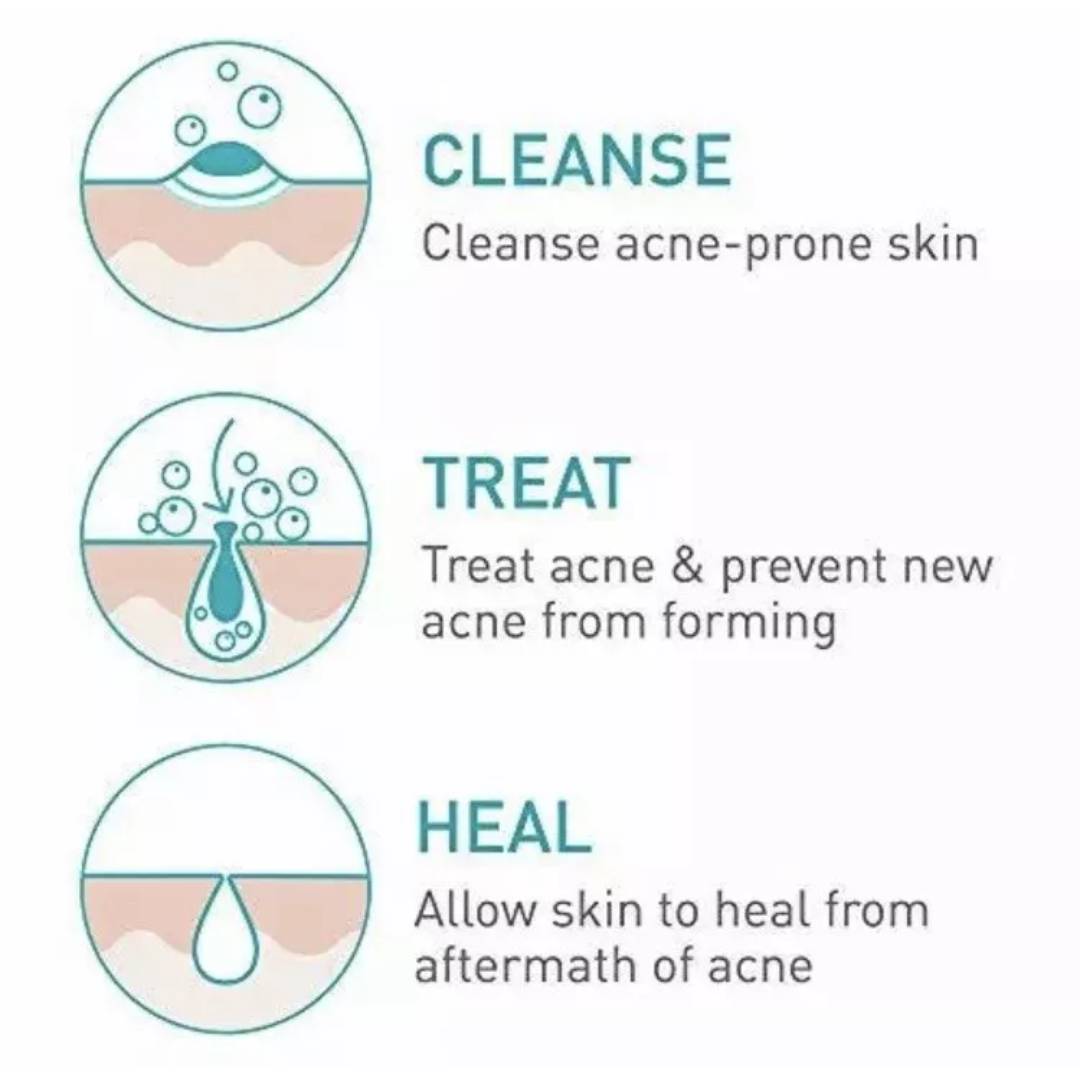 CeraVe Acne Foaming Cream Cleanser