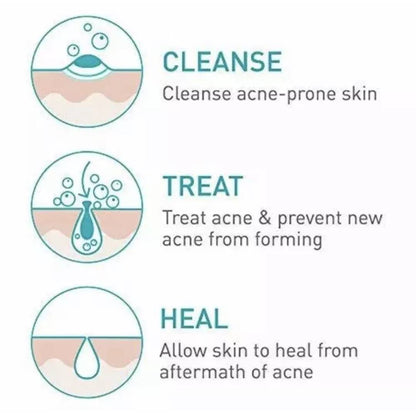 CeraVe Acne Foaming Cream Cleanser