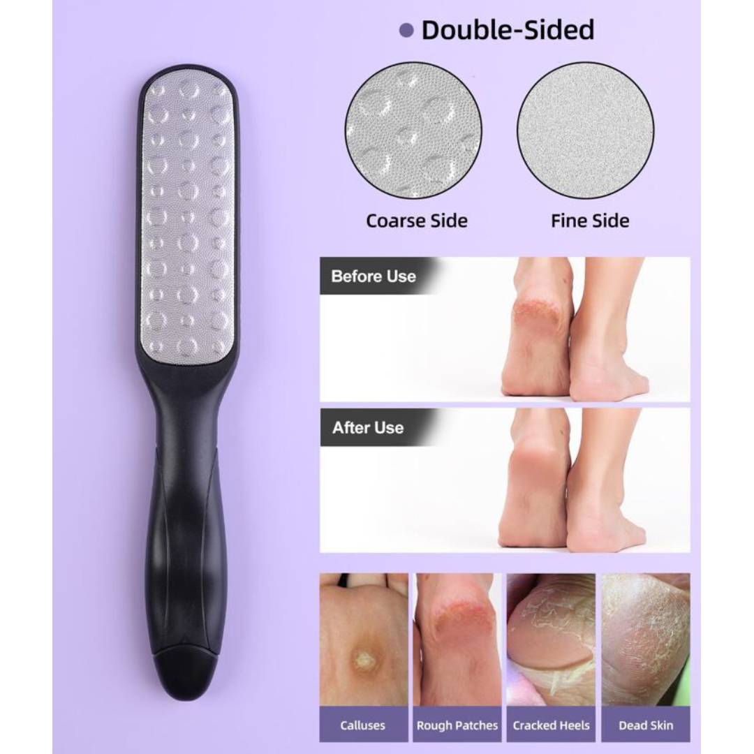 Foot Callus Remover Grinding Filler Foot File Tool With Plastic Handle