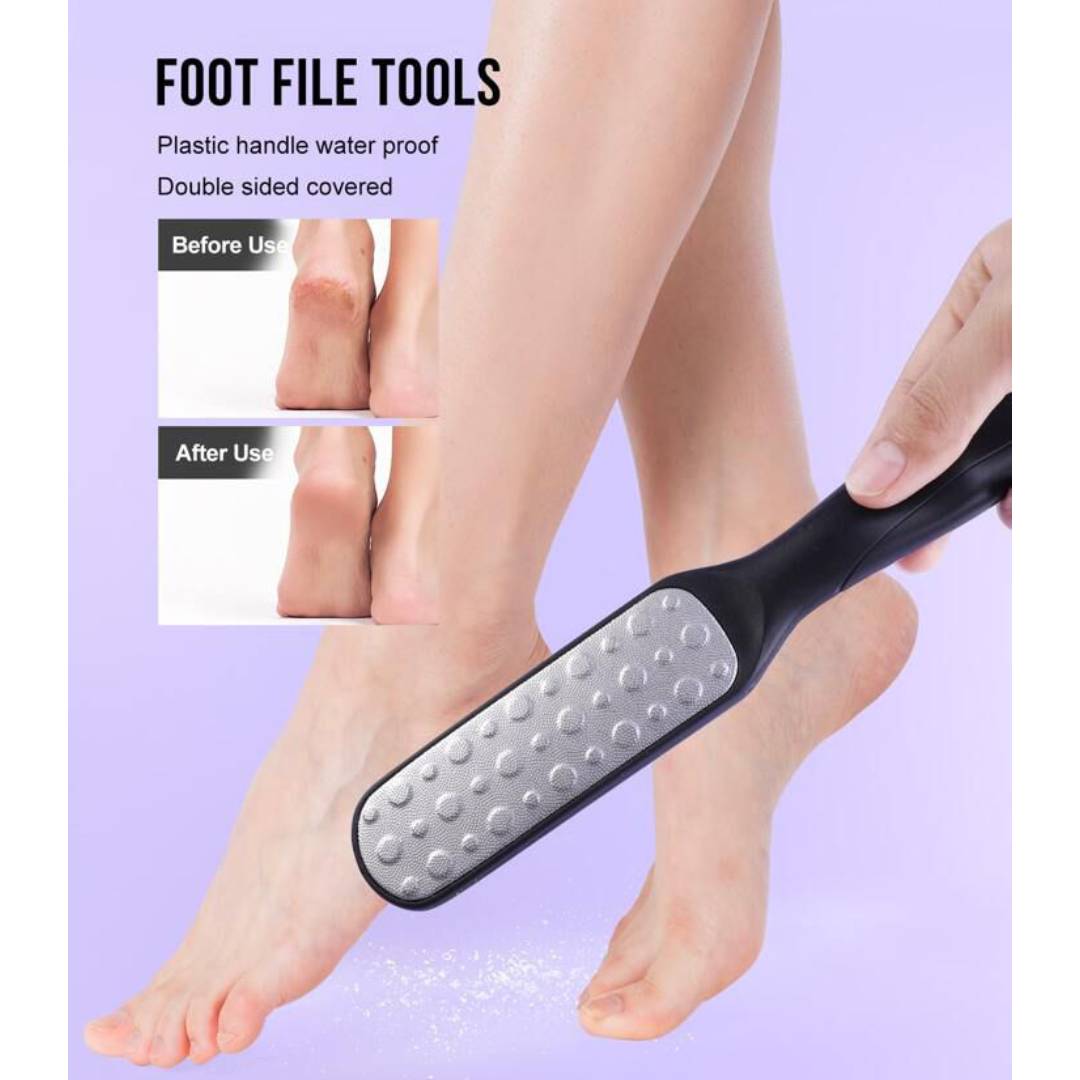 Foot Callus Remover Grinding Filler Foot File Tool With Plastic Handle