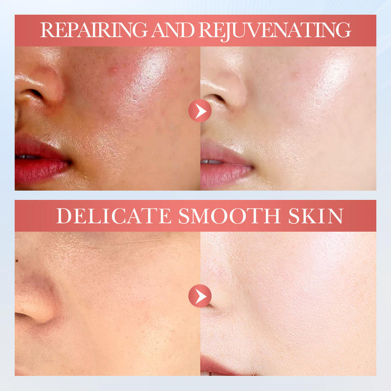 Sadoer Niacinamide Hydrating, Nourishing & Repairing Gel with Watermelon & Aloe Vera Extract