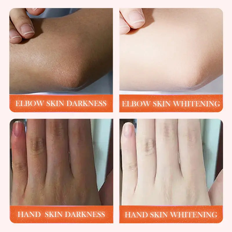 SADOER Niacinamide Vitamin C Whitening Dark Knuckle Dispelling Black Serum 50ml