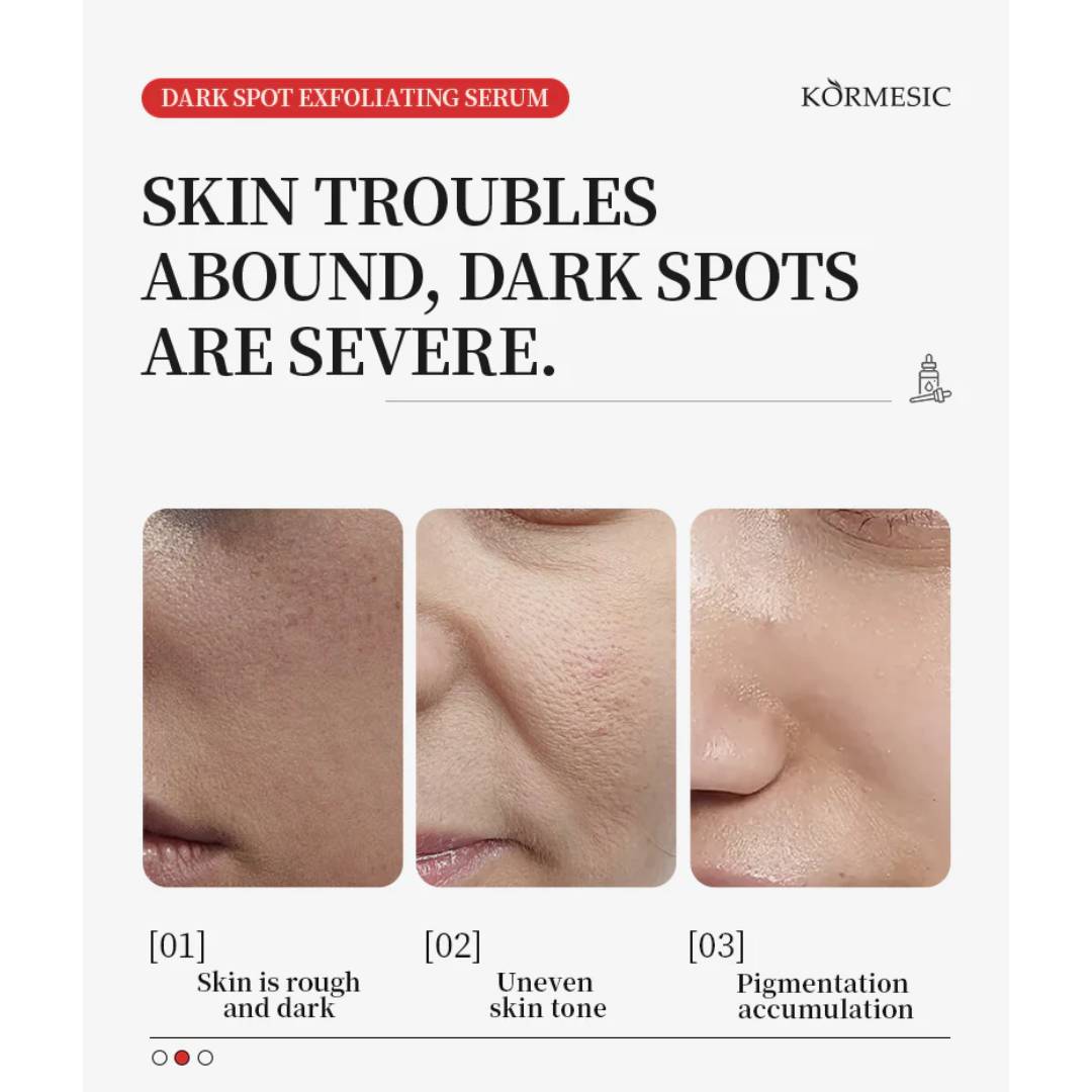 Kormesic Dark Spot Exfoliating Salicylic Acid Niacinamide AHA Serum 40ml