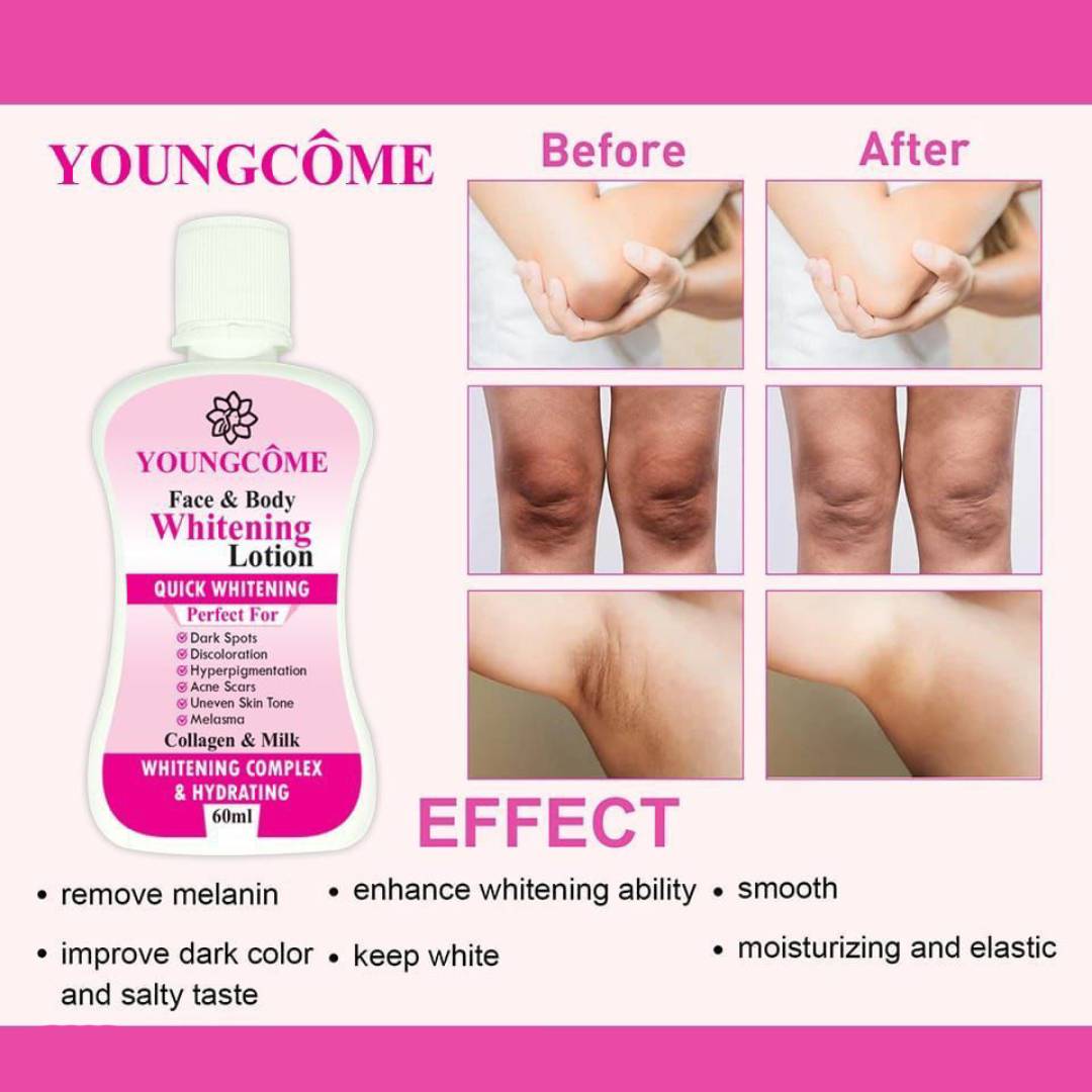 Youngcome Face & Body Whitening Lotion