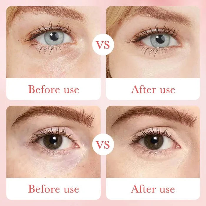 BIOAQUA Rose Hyaluronic Acid Moisturizing Eye Mask 30 Pairs 80g