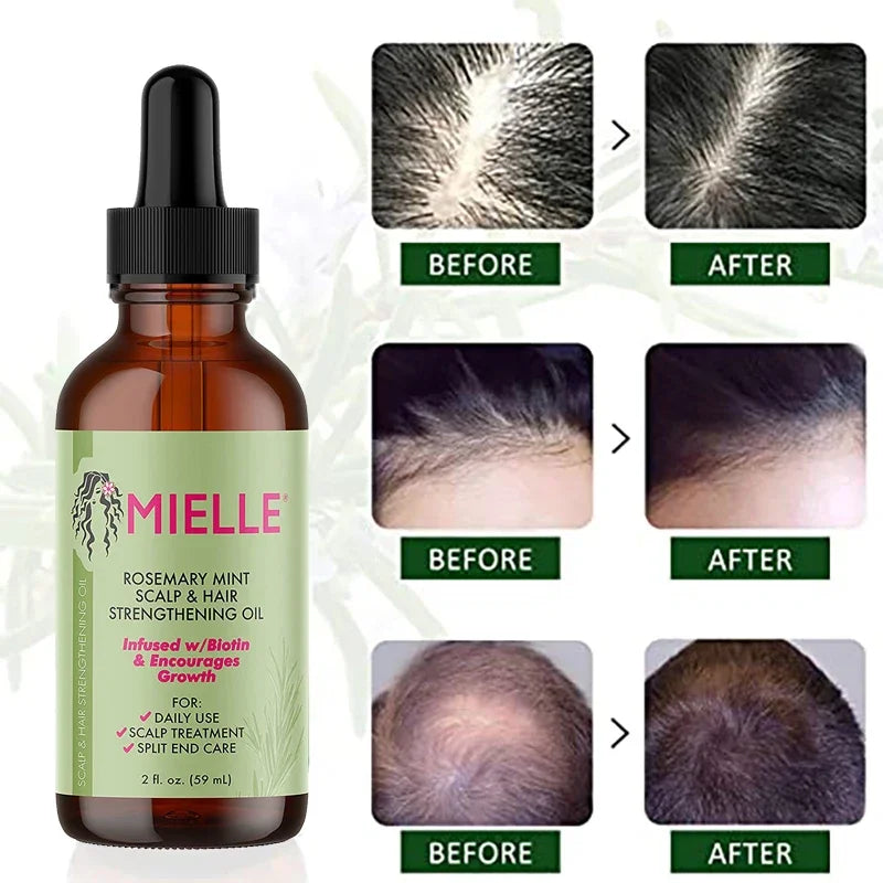 MIELLE Rosemary Mint Scalp And Hair Strengthening Oil And Hair Growth Essential Oil