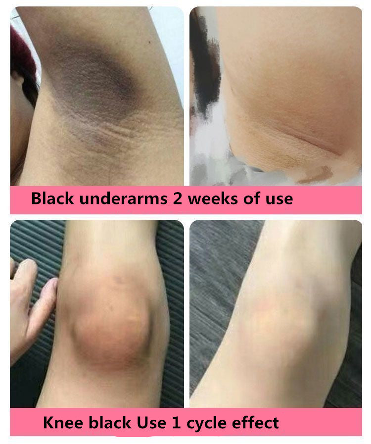 Kojic Acid Collagen Detox Whitening Face Cleansing Gel