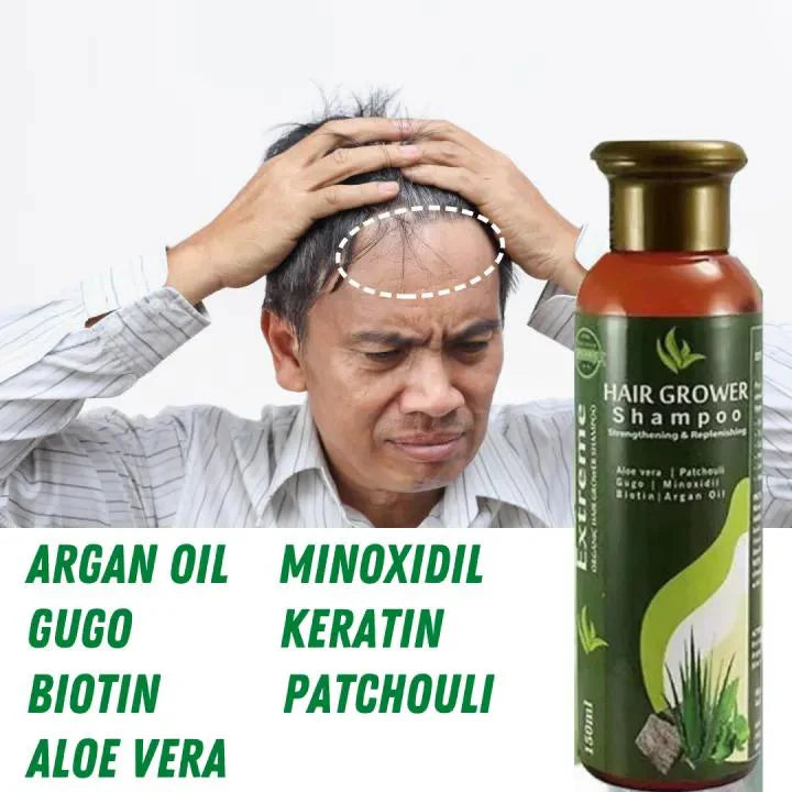 Sunisa Aloe Vera Hair Growth Shampoo 150ml