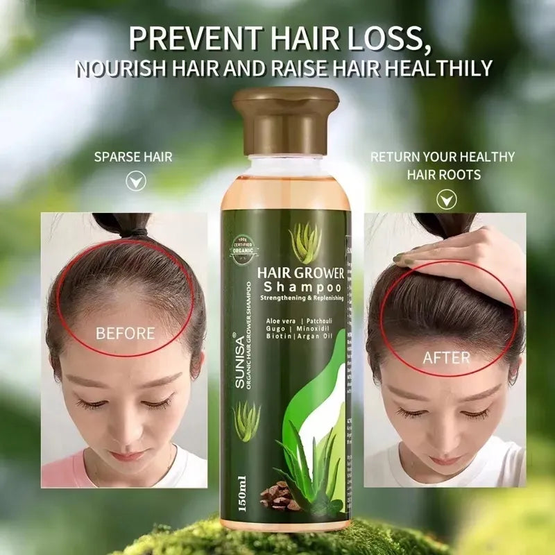 Sunisa Aloe Vera Hair Growth Shampoo 150ml