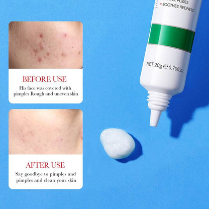 Bioaqua Salicylic Acid Acne Removal Cream 20g