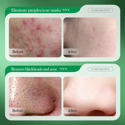 Sadoer Korean Salicylic Acid Nourishing Cotton Sheet Face Mask Vegan Tender Smooth Herbal