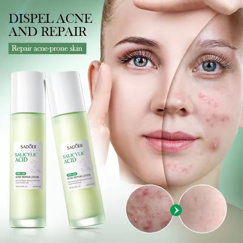 Sadoer 3% Salicylic Acid Skincare Dark Spot Acne Essence Lotion Niacinamide Repair Nourishing Whitening Brighten Moisturizing Lotion
