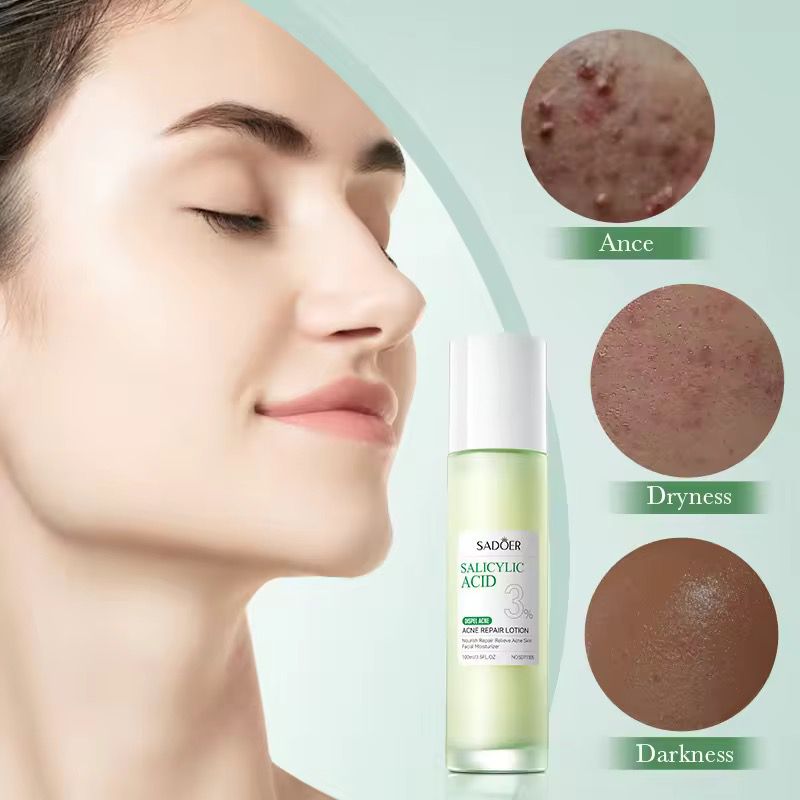 Sadoer 3% Salicylic Acid Skincare Dark Spot Acne Essence Lotion Niacinamide Repair Nourishing Whitening Brighten Moisturizing Lotion