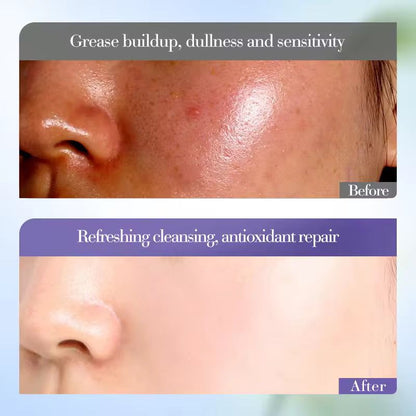 Sadoer Acid Whitening Brightens Skin Face Wash Organic Skincare Deep Clean Facial Cleanser