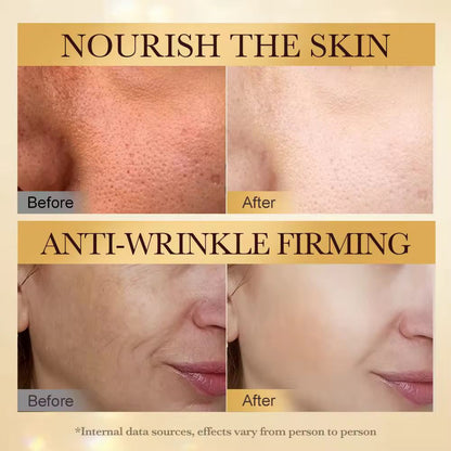 Sadoer Bee Venom Anti Wrinkle Serum Nourishing Hydrating