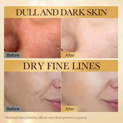 Sadoer Bee Venom Collagen Face Cream For Women And Men