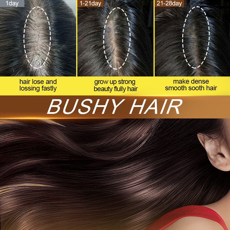 Sadoer Barana Scalp Soothing Dense Hair Ball