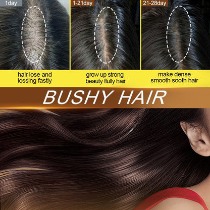 Sadoer Barana Scalp Soothing Dense Hair Ball