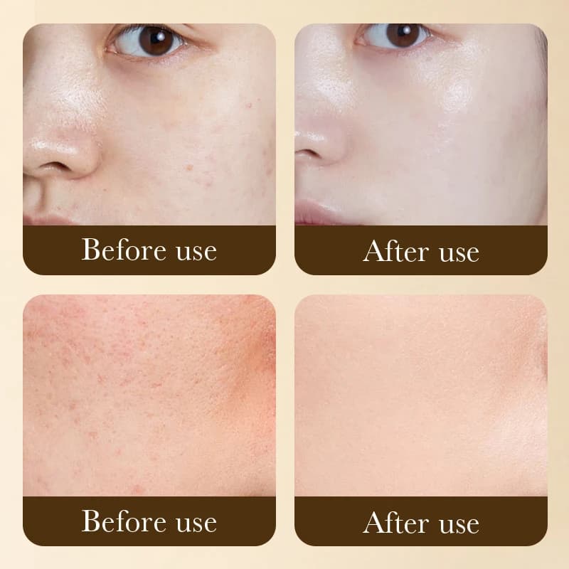 SADOER  Retinol Anti-Aging Face Cream For Men & Women