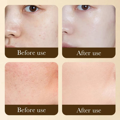 SADOER  Retinol Anti-Aging Face Cream For Men & Women