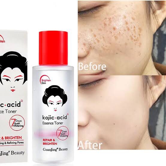 GuanJing Kojic Acid Repair And Brighten Face Essence Toner